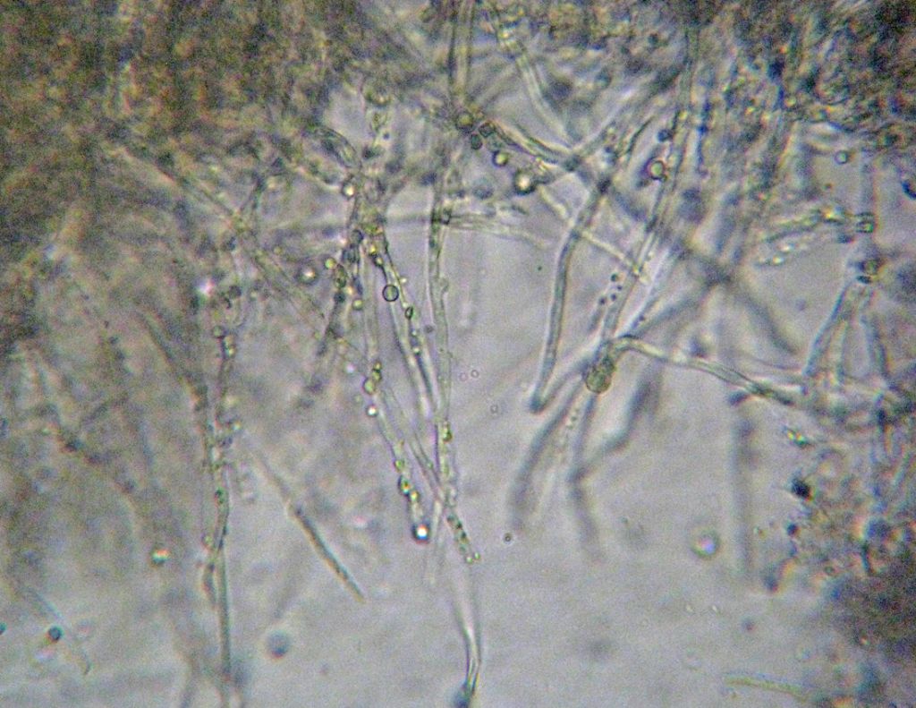 Steccherinum?